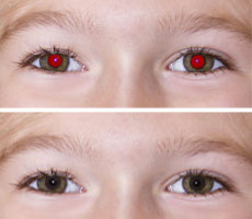 How to Get Rid of Red Eyes